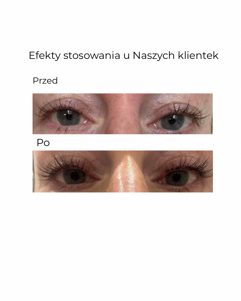 Éleverlash